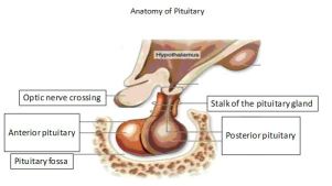 pituitary_pit